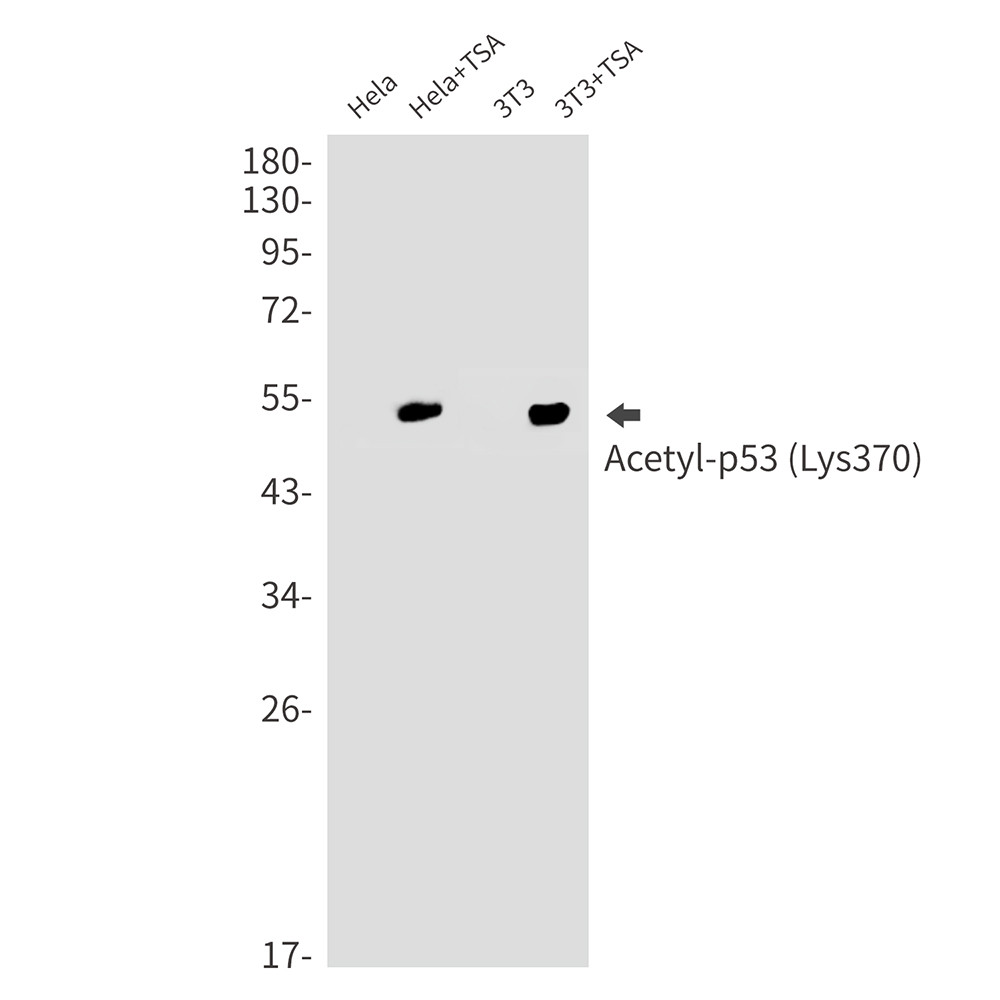 Rabbit Monoclonal Antibody to Acetyl-p53 (Lys370)