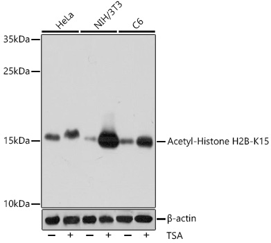 Rabbit Polyclonal Antibody to Acetyl-Histone H2B (Lys15)