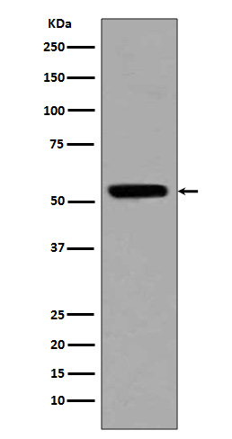 Rabbit Polyclonal Antibody to Acetyl-p53 (Lys370)