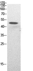 Rabbit Polyclonal Antibody to Acetyl-p53 (Lys382)
