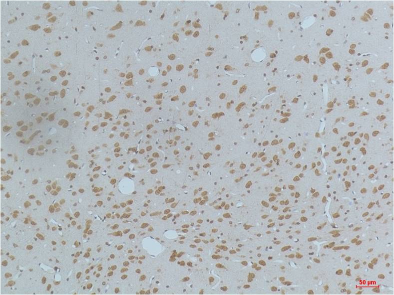 Mouse Monoclonal Antibody to Phospho-CaMKII (Thr287)