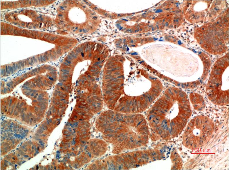 Mouse Monoclonal Antibody to Phospho-ERK1/2 (Tyr222/Tyr205)
