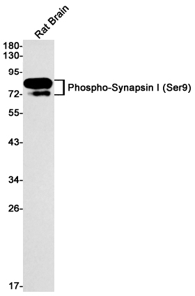 Rabbit Monoclonal Antibody to Phospho-Synapsin I (Ser9)