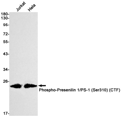 Rabbit Monoclonal Antibody to Phospho-Presenilin 1 (Ser310)