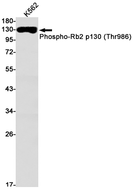 Rabbit Monoclonal Antibody to Phospho-Rb2 p130 (Thr986)
