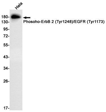 Rabbit Monoclonal Antibody to Phosoho-ErbB 2/EGFR (Tyr1248/Tyr1173)