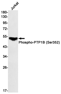 Rabbit Monoclonal Antibody to Phospho-PTP1B (Ser352)