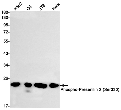 Rabbit Monoclonal Antibody to Phospho-Presenilin 2 (Ser330)