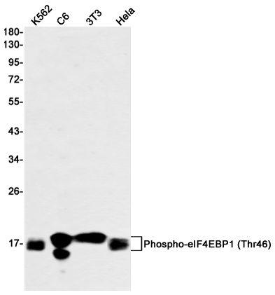 Rabbit Monoclonal Antibody to Phospho-4E BP1 (Thr46)