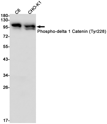 Rabbit Monoclonal Antibody to Phospho-delta 1 Catenin (Tyr228)