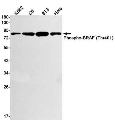 Rabbit Monoclonal Antibody to Phospho-BRAF (Thr401)