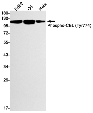 Rabbit Monoclonal Antibody to Phospho-CBL (Tyr774)