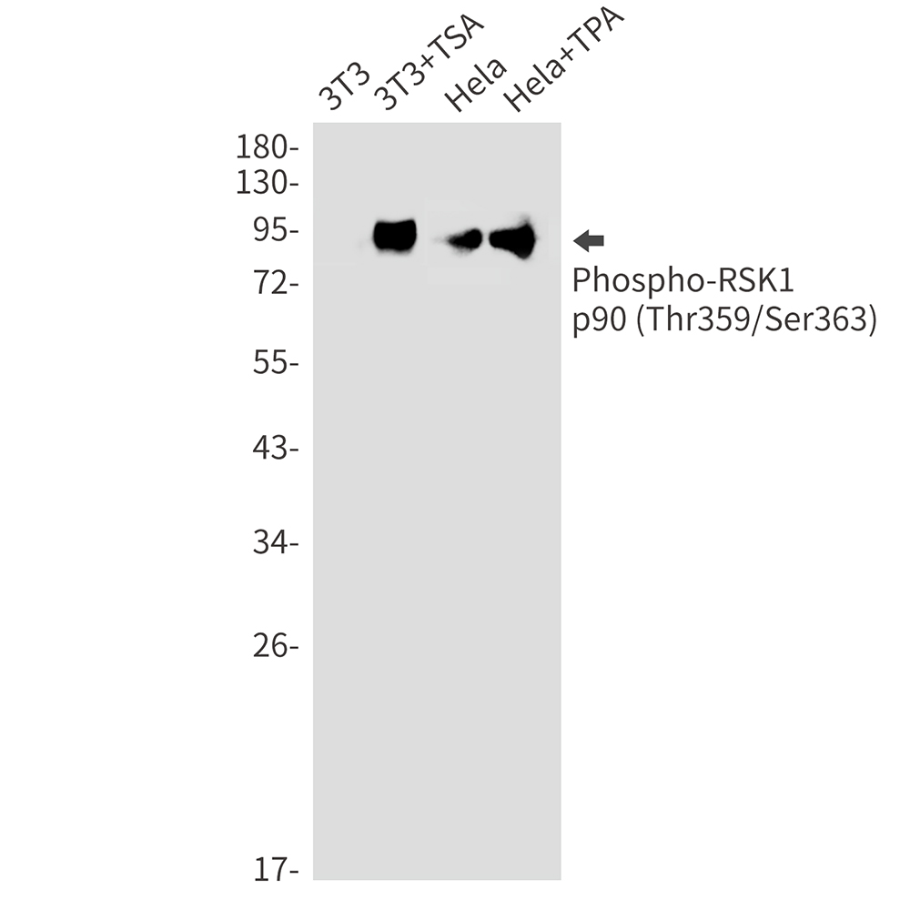 Rabbit Monoclonal Antibody to Phospho-RSK1 p90 (Thr359/Ser363)