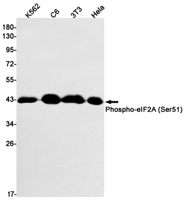 Rabbit Monoclonal Antibody to Phospho-eIF2A (Ser51)