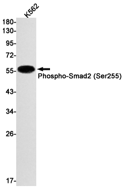 Rabbit Monoclonal Antibody to Phospho-Smad2 (Ser255)