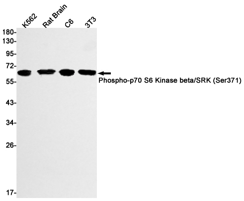 Rabbit Monoclonal Antibody to Phospho-S6K2 (Ser371)