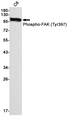 Rabbit Monoclonal Antibody to Phospho-FAK (Tyr397)