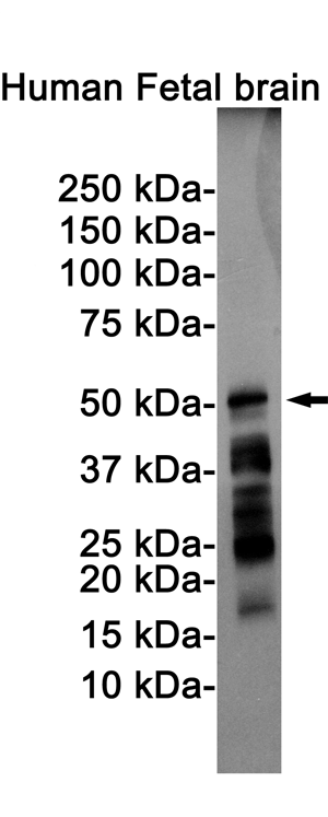 Rabbit Monoclonal Antibody to Phospho-Tau (Ser198)