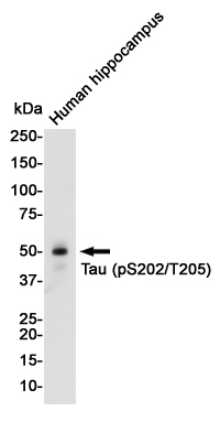 Rabbit Monoclonal Antibody to Phospho-Tau (Ser202/Thr205)