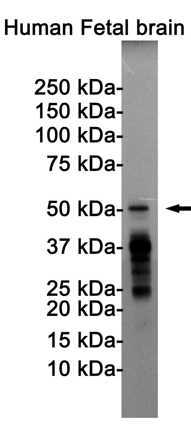 Rabbit Monoclonal Antibody to Phospho-Tau (Thr205)