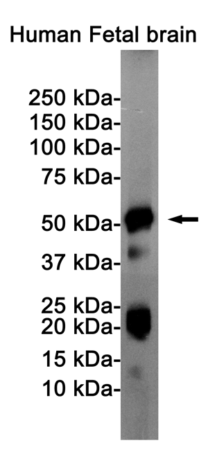 Rabbit Monoclonal Antibody to Phospho-Tau (Ser404)