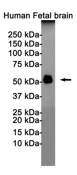 Rabbit Monoclonal Antibody to Phospho-Tau (Thr181)