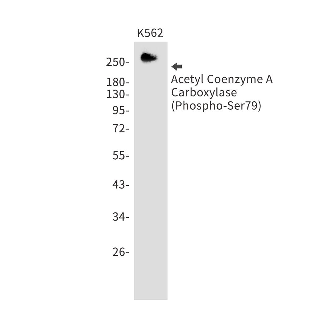 Rabbit Monoclonal Antibody to Phospho-Acetyl Coenzyme A Carboxylase (Ser79)