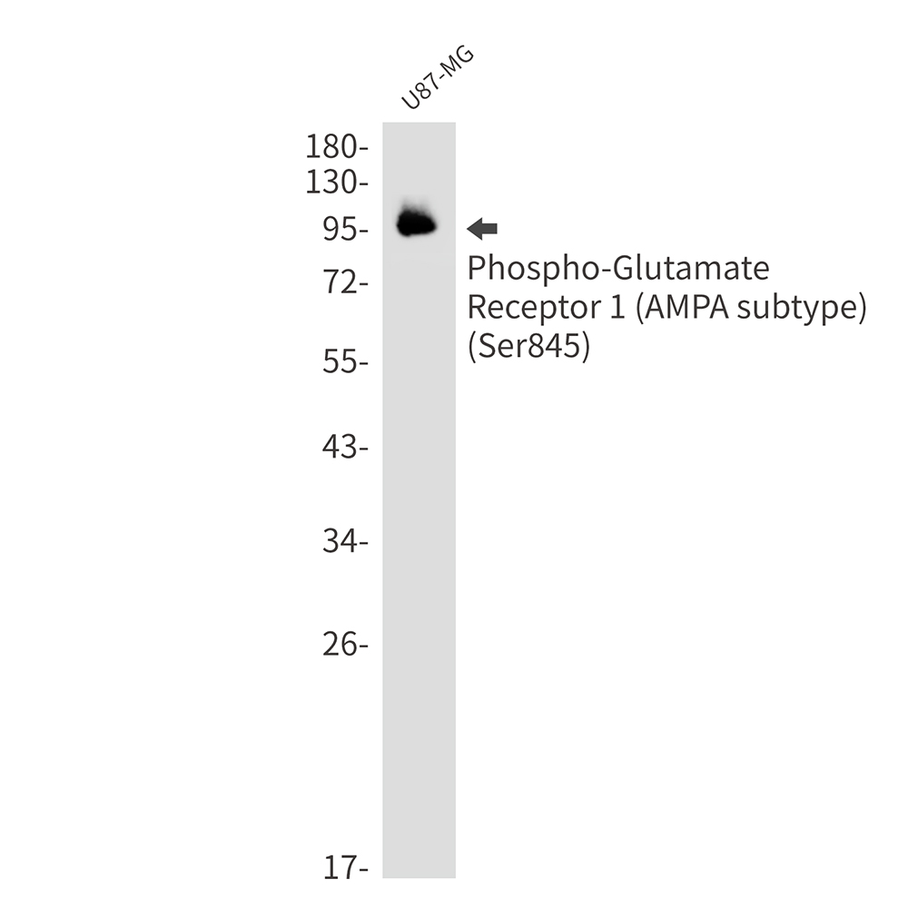 Rabbit Monoclonal Antibody to Phospho-Glutamate Receptor 1 (AMPA Subtype) (Ser845)
