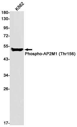 Rabbit Monoclonal Antibody to Phospho-AP2M1 (Thr156)