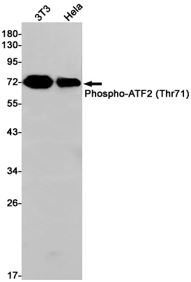 Rabbit Monoclonal Antibody to Phospho-ATF2 (Thr71)