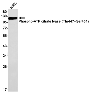 Rabbit Monoclonal Antibody to Phospho-ATP Citrate Synthase (Thr447/Ser451)