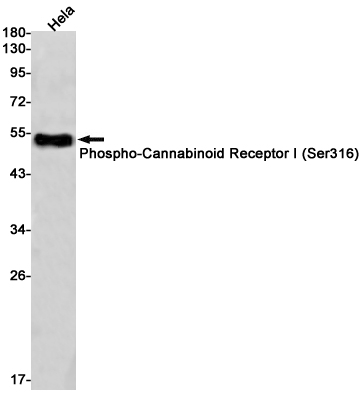 Rabbit Monoclonal Antibody to Phospho-Cannabinoid Receptor I (Ser316)
