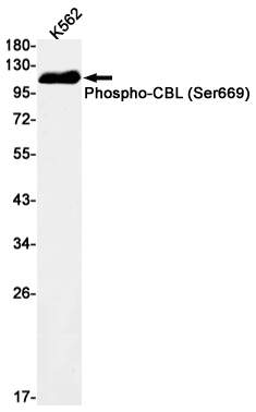 Rabbit Monoclonal Antibody to Phospho-CBL (Ser669)