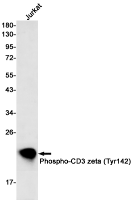 Rabbit Monoclonal Antibody to Phospho-CD3 zeta (Tyr142)
