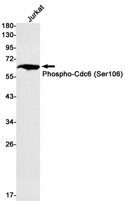 Rabbit Monoclonal Antibody to Phospho-CDC6 (Ser106)