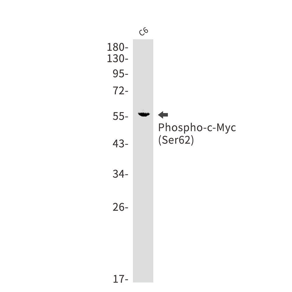 Rabbit Monoclonal Antibody to Phospho-c-Myc (Ser62)