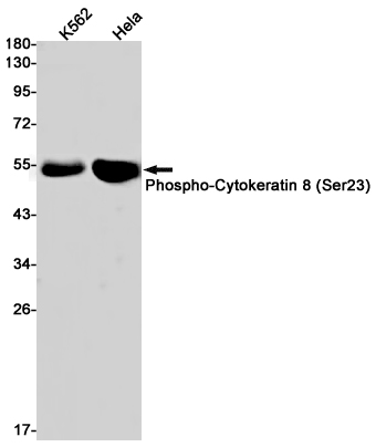 Rabbit Monoclonal Antibody to Phospho-Cytokeratin 8 (Ser23)