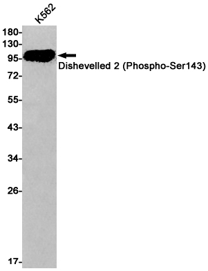 Rabbit Monoclonal Antibody to Phospho-Dishevelled 2 (Ser143)