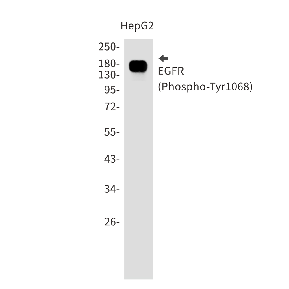 Rabbit Monoclonal Antibody to Phospho-EGFR (Tyr1068)