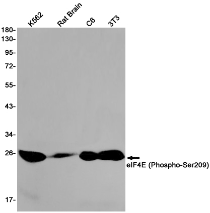 Rabbit Monoclonal Antibody to Phospho-eIF4E (Ser209)