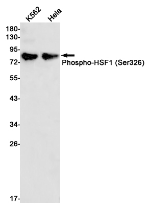 Rabbit Monoclonal Antibody to Phospho-HSF1 (Ser326)