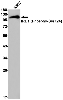 Rabbit Monoclonal Antibody to Phospho-IRE1 (Ser724)