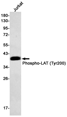 Rabbit Monoclonal Antibody to Phospho-LAT (Tyr200)