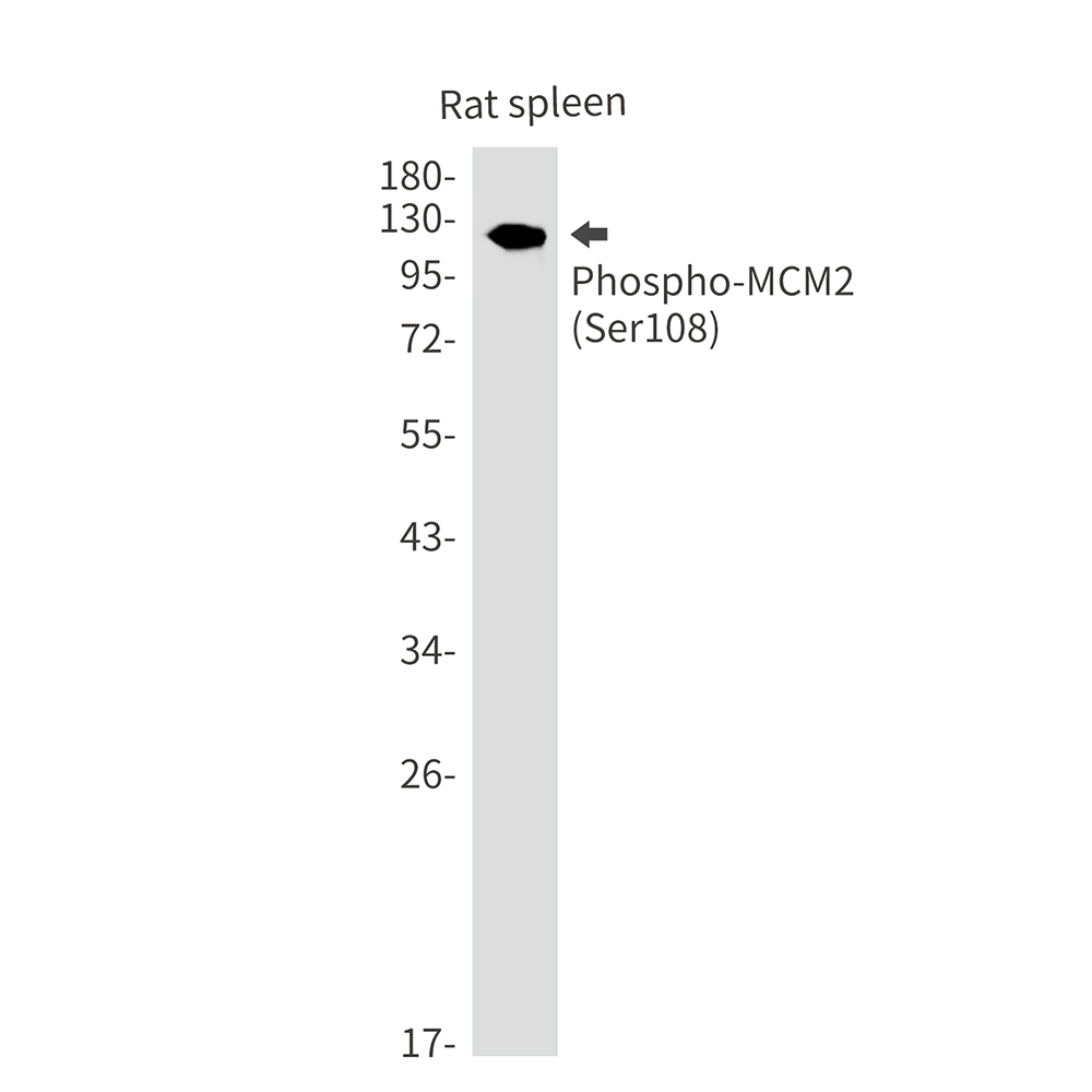 Rabbit Monoclonal Antibody to Phospho-MCM2 (Ser108)