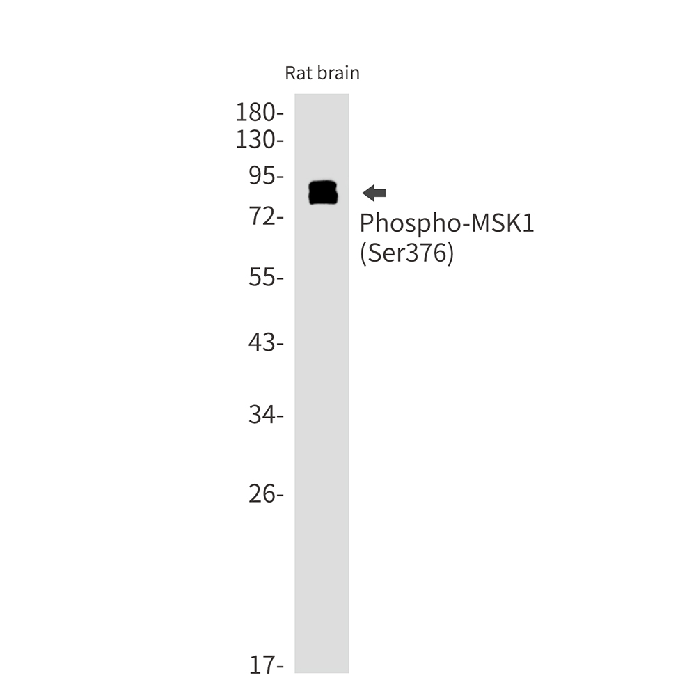 Rabbit Monoclonal Antibody to Phospho-MSK1 (Ser376)