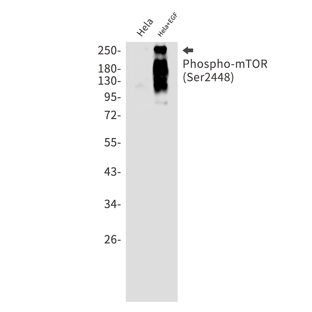 Rabbit Monoclonal Antibody to Phospho-mTOR (Ser2448)