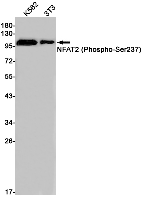 Rabbit Monoclonal Antibody to Phospho-NFAT2 (Ser237)
