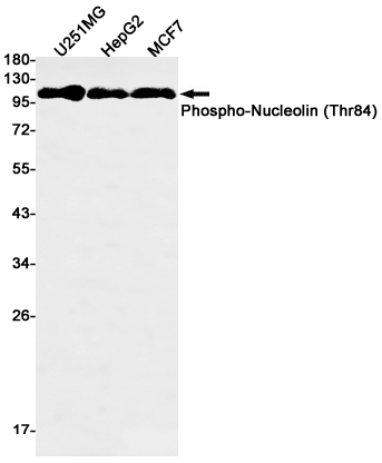 Rabbit Monoclonal Antibody to Phospho-Nucleolin (Thr84)