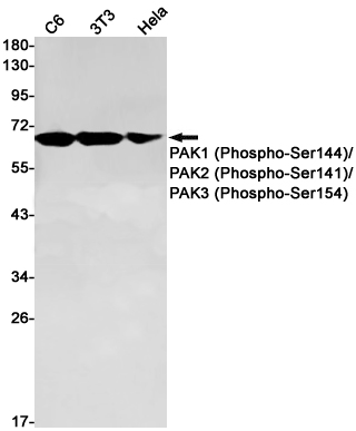 Rabbit Monoclonal Antibody to Phospho-PAK1/2/3 (Ser144/Ser141/Ser154)