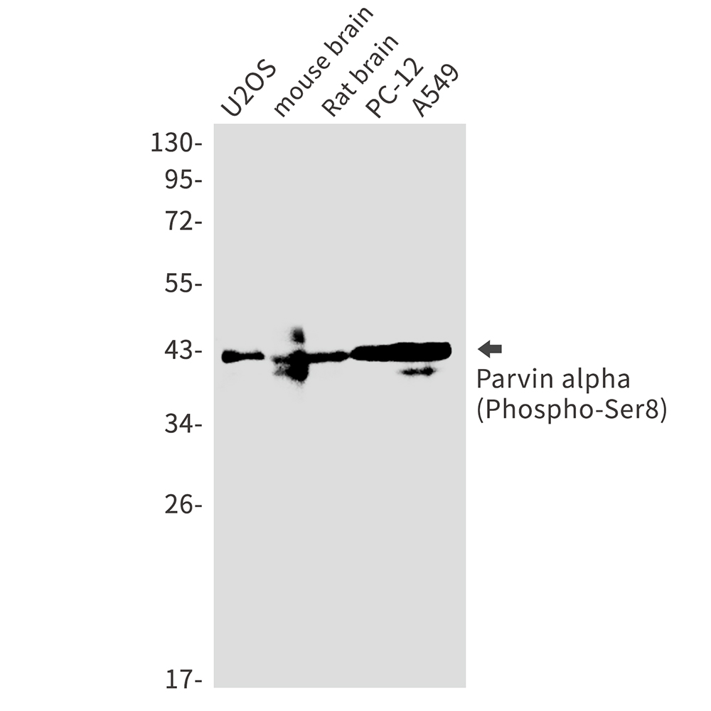 Rabbit Monoclonal Antibody to Phospho-Parvin alpha (Ser8)